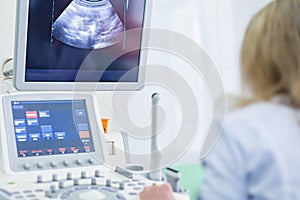 The doctor examines the patient on a computer. Ultrasound machine