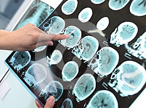 Doctor examines the patient tomogram