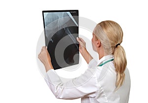 Doctor examines x- ray