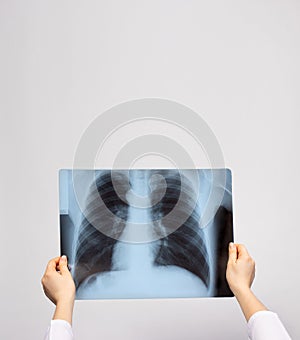 A doctor examines an X-ray of the lungs of a patient with pneumonia. Pulmonology and radiology, lung disease. With place for text