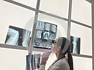 Doctor examines x-ray in medical office closeup