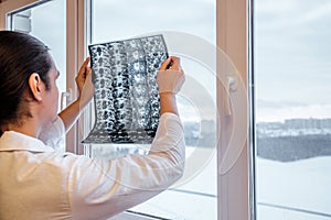 Doctor examines results of Magnetic resonance imaging MRI of Hip Joint. Selective focus