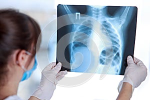 Doctor examines an X-ray