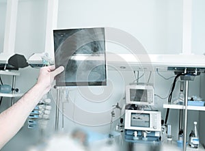 Doctor examines an x-ray picture of the patient