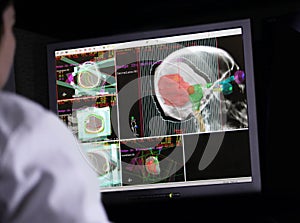 Doctor examining a brain scan on computer