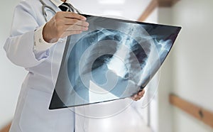 Doctor examining chest x-ray film