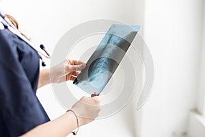 Doctor examining chest x-ray film of patient at hospital on white background, copy space