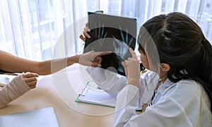 A doctor examining the hand and arm x-ray film Including the body at the hospital