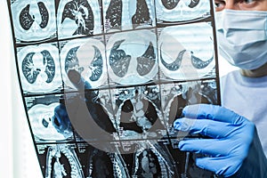 Doctor examining head MRI image in hospital