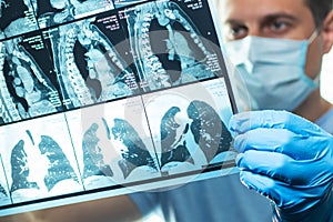 Doctor examining head MRI image in hospital