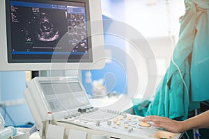 Doctor is examining heart`s patient by echocardiogram for diagnosis disease or explain symptom.