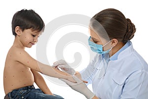 Doctor examining little boy with chickenpox on background. Varicella zoster virus