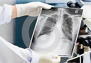 Doctor examining a lung radiography, Doctor looking chest x-ray film.