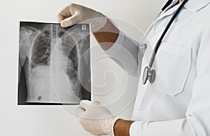 Doctor examining a lung radiography, Doctor looking chest x-ray film,Anatomy.