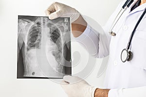 Doctor examining a lung radiography, Doctor looking chest x-ray film,Anatomy.