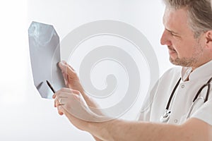 Doctor examining lung`s x-ray