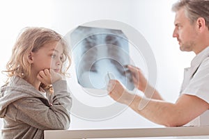 Doctor examining lung`s x-ray of cute little child in the hospital