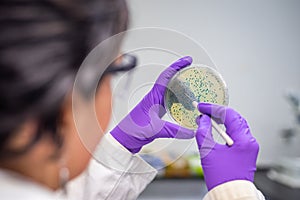 Doctor examining meningococcal bacterial culture plate