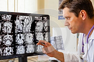 Doctor examining an MRI scan of the Brain photo