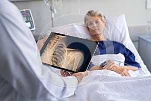 Doctor examining patient x-ray