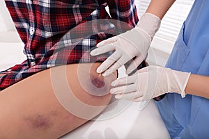 Doctor examining patient`s bruised hip in hospital, closeup