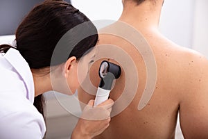 Doctor Examining Pigmented Skin On Man`s Back