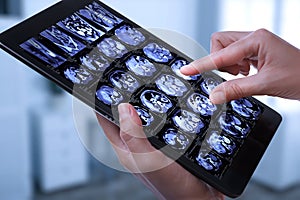 Doctor examining x-ray images on tablet indoors, closeup