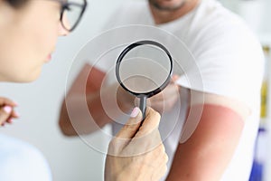 Doctor examining sunburns on patient arm using magnifying glass closeup