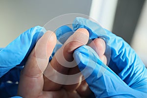 Doctor in gloves holding fingers of patient checking skin