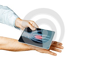 Doctor Hand With Digital Tablet Scans Patient Hand, Modern X-Ray Technology In Medicine And Healthcare Concept Isolated Background