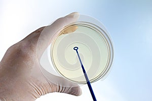 doctor with a hand holding a petri dish and the other an inoculation loops photo