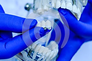 Doctor hands holding teeth model in dental clinic. Teeth model held by real dentist with blue gloves. Dentist showing a jaw model