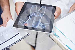 Doctor, hands and tablet with x ray in anatomy, surgery or results in MRI, CT or body scan at hospital. Closeup of