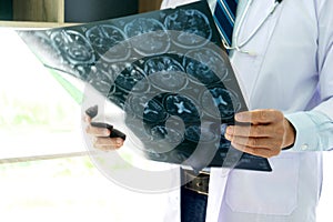Doctor hold brain X-ray scan film