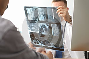 Doctor hold xray bone spine radiography in hand