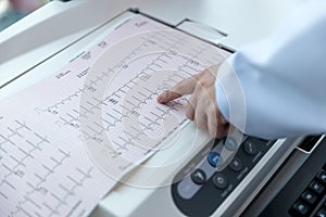 Doctor holding a cardiogram test. Doctor with electrocardiogram equipment making cardiogram test to patient in clinic.