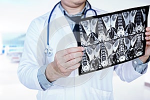 Doctor holding and checking chest x-ray film or roentgen image i