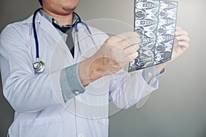 Doctor holding and checking chest x-ray film or roentgen image i