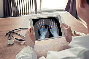 Doctor holding a digital tablet with pain on the joints of the fingers. Osteoarthritis concept