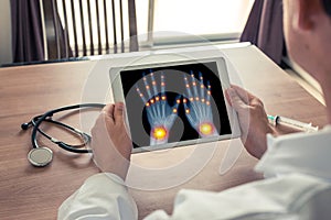 Doctor holding a digital tablet with pain on the joints of right and left hands. Osteoarthritis concept