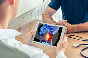 Doctor holding a digital tablet with x-ray of the 3D head of the patient with pain on the neck. Migraine headache concept