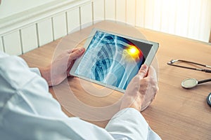 Doctor holding a digital tablet with x-ray of a chest. Pain on the shoulder