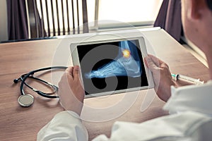 Doctor holding a digital tablet with x-ray of foot and pain on the ankle. Sprain concept