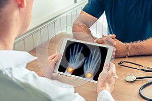 Doctor holding a digital tablet with x-ray of hands of the patient. Pain on the wrists. Osteoarthritis concept