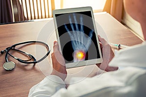 Doctor holding a digital tablet with x-ray of a left hand with osteoarthritis pain on the wrist. Stethoscope on the desk.