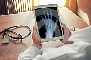 Doctor holding a digital tablet with x-ray of a left hand. Stethoscope and syringe on the desk. Osteoarthritis concept