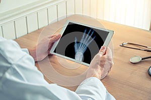 Doctor holding a digital tablet and x-ray of  a right hand. Osteoarthritis concept