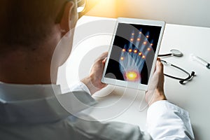 Doctor holding a digital tablet with x-ray of a right hand with pain on the joints of fingers and wrist. Osteoarthritis concept