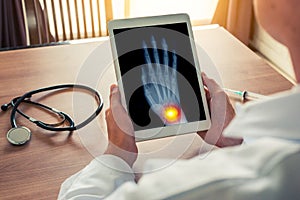 Doctor holding a digital tablet with x-ray of a right hand with pain on the wrist. Osteoarthritis concept