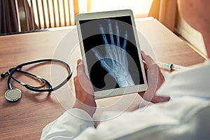 Doctor holding a digital tablet with x-ray of a right hand. Stethoscope and syringe on the desk. Osteoarthritis concept
